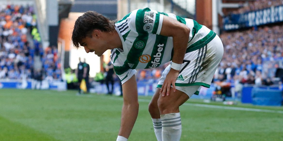 £17k-p/w Celtic Man Slammed After 2-2 Draw